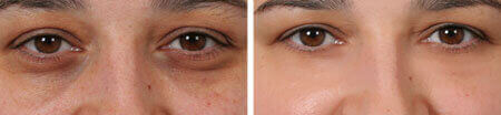 Before & After